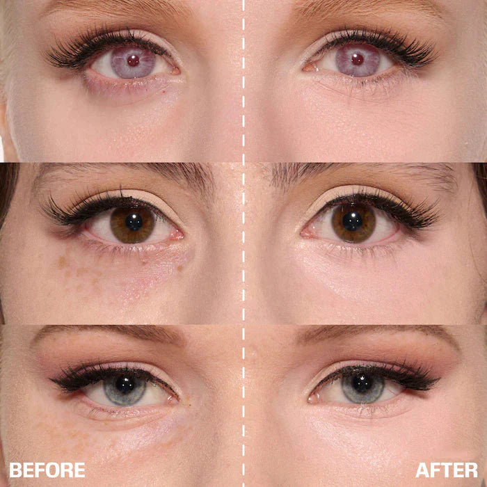 ✨ LAST DAY BUY 1 GET 1 FREE✨Cemenrete Calcium Dark Spot Eye Cream | Dark Circle, Anti-aging, Sagging, Elasticity