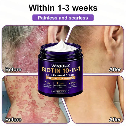 Windolix® Biotin 10-in-1 Skin Restoration Cream