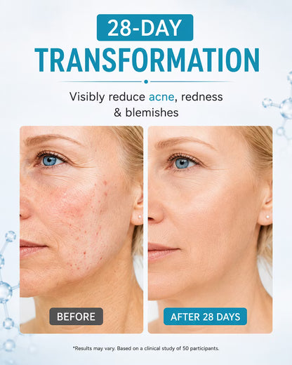 🥳2026 HOT SALE🥳💞50K+ SOLD!🌿💧 50% OFF! NIDA Youthful Formula – Centella Asiatica calms, Bifida strengthens. Reduces wrinkles, restores radiance. 🔥💝