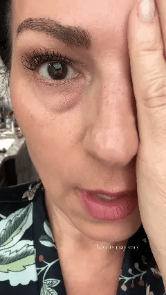 🔥ROZINO Firming Eye Cream with Natural Honey