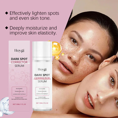 Advanced Dark Spot Corrector Serum -Multi-Correction Brightening Formulafor Sun Spots, Age Spots, and Melasma-XXS