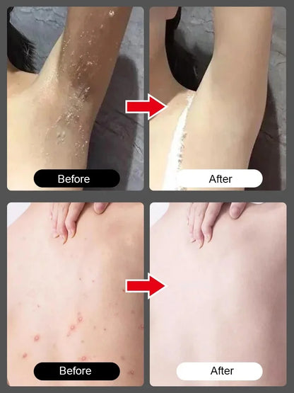 [Instant Whitening] Body Exfoliating Nicotinamide Gel