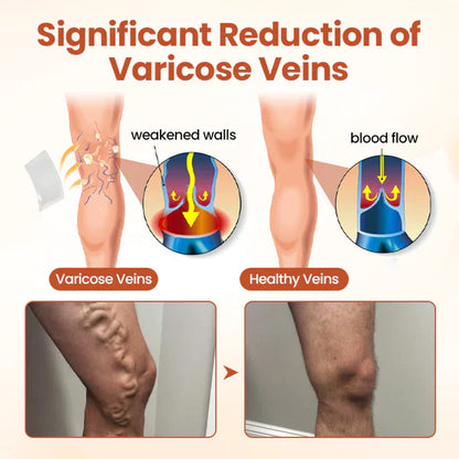 VeinTarget Microneedle Patch