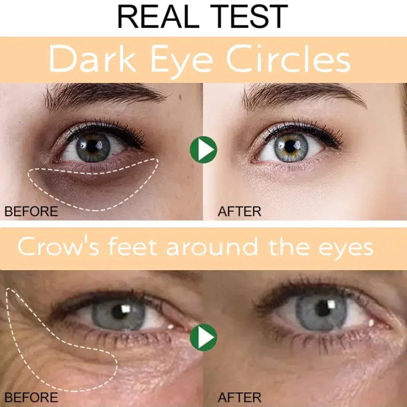Instant Eye Bag Removal Cream Collagen Removal Wrinkles Firming Skin Fade Fine Lines Brighten Dark Circle