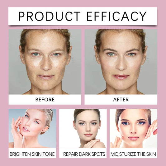 🔥Limited Time Offer🔥Advanced Dark Spot Corrector Serum -Multi-Correction Brightening Formulafor Sun Spots, Age Spots, and Melasma-XXS