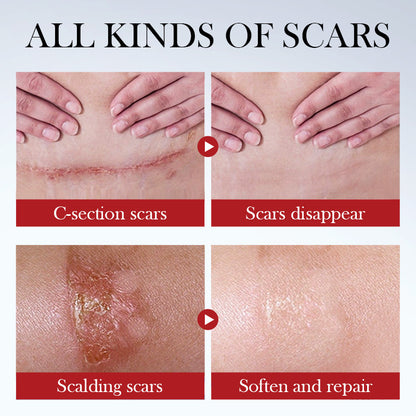 SADOER Scar Repair Cream