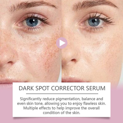 Advanced Dark Spot Corrector Serum -Multi-Correction Brightening Formulafor Sun Spots, Age Spots, and Melasma-XXS