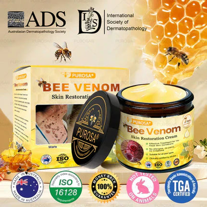 🐝PUROSA® Bee Venom Skin Treatment Cream, Anti-aging, Hydrating, Skin Repair, Even Tone, Acne and Dark Spot Treatment, Wart and Mole Removal, Psoriasis Relief