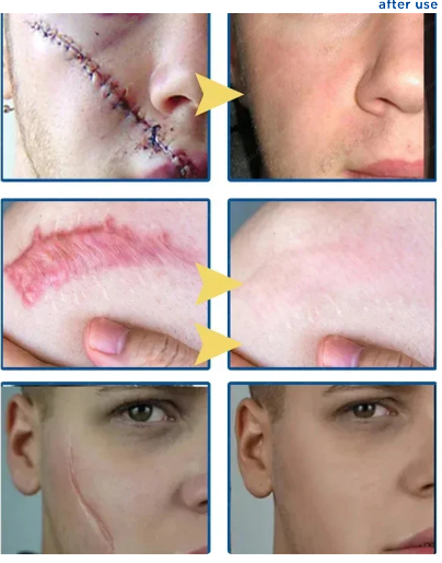 MEJISOO  Reduces pigmentation fades scarsand lightens burns.