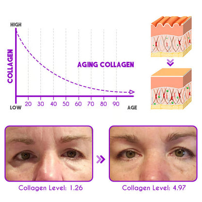 👀DEleventh Pro-Xylane Active Eye Cream🤩😍💃🏼