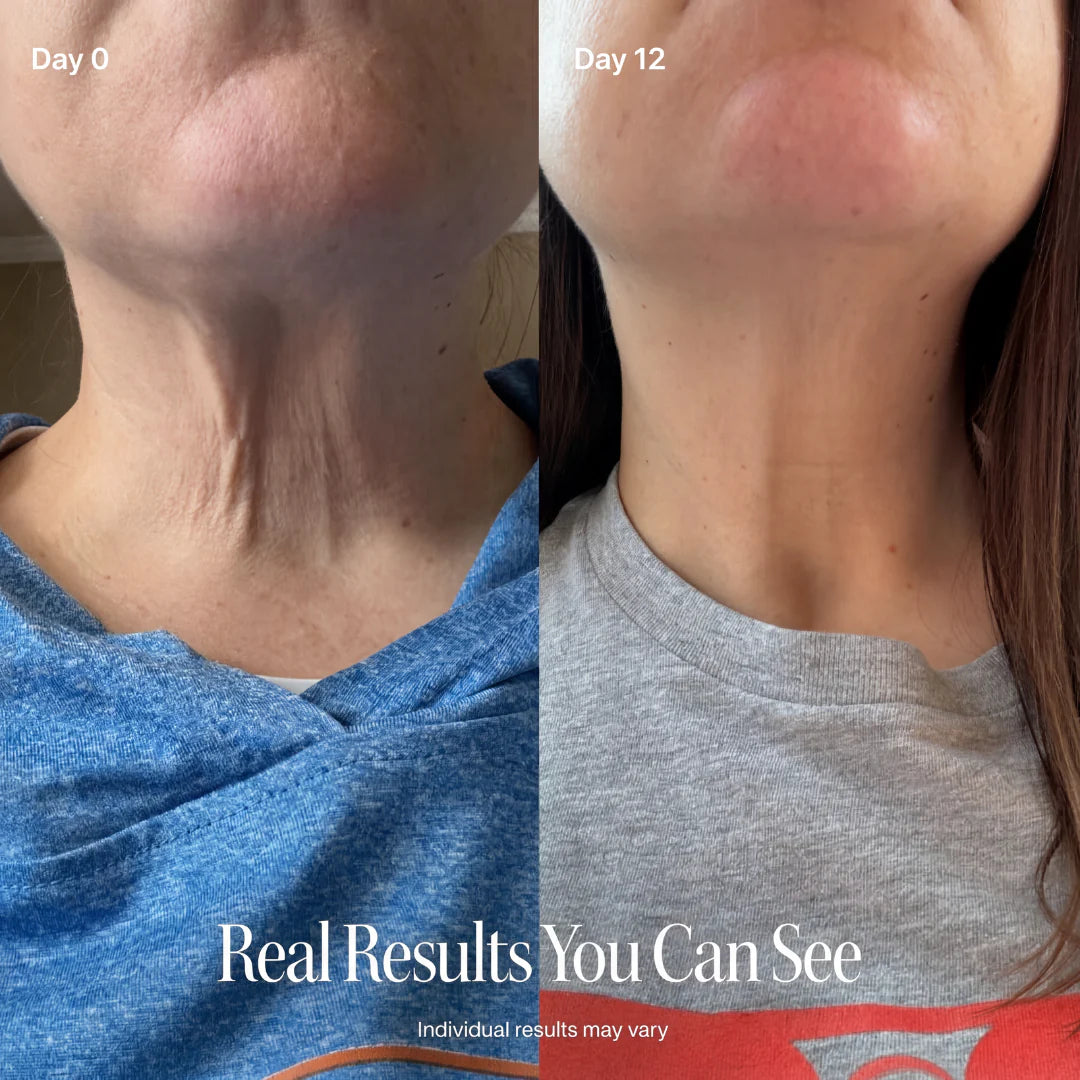 PEPTIDE Face Slimming Cream