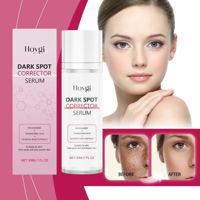 Advanced Dark Spot Corrector Serum -Multi-Correction Brightening Formulafor Sun Spots, Age Spots, and Melasma-XXS