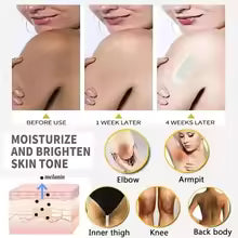 #1 Dermatologist-Recommended Cream for Dark Spots in Sensitive Areas