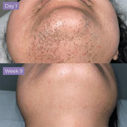 Velura Skin Cyperus Rotundus Serum