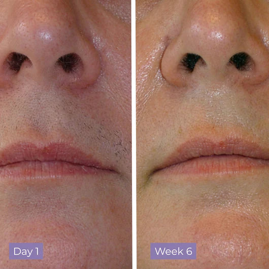 Velura Skin Cyperus Rotundus Serum