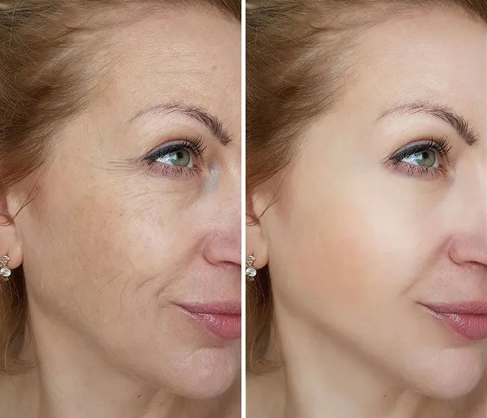 5X Pro-XylaneAnti Aging Mouizturizing Cream