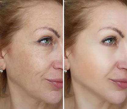 5X Pro-XylaneAnti Aging Mouizturizing Cream