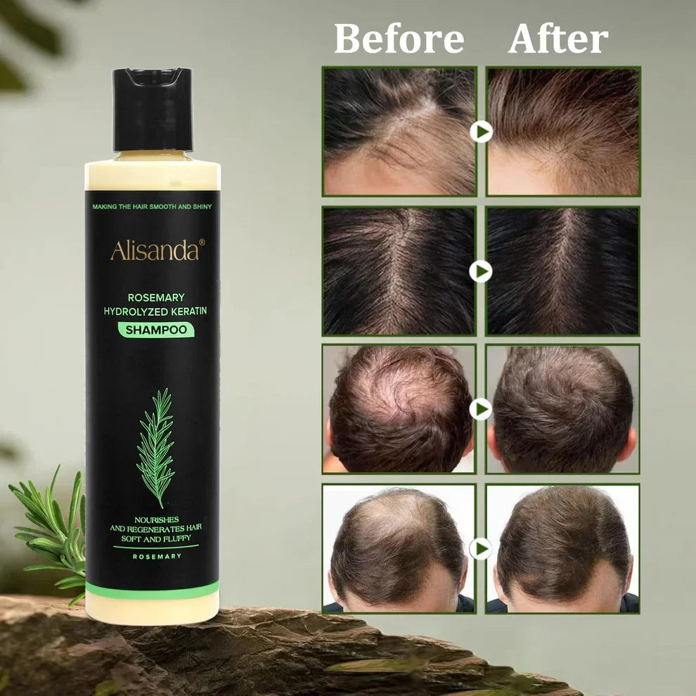 🔥LAST DAY 50% OFF - 🎅Alisanda® Organic Rosemary Hair Growth Shampoo