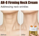 👩‍🦰 Hot Sale 49% OFF🌿 - Neck Firming Cream