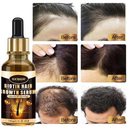 BIOTIN HAIR GROWTH SERUN