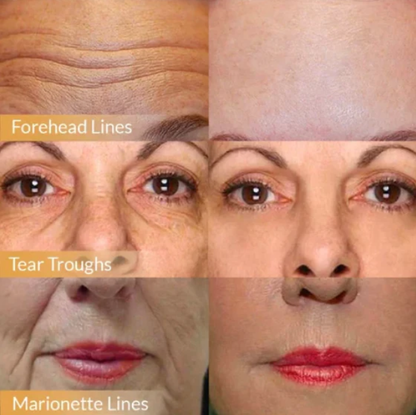 ✨2025 Hot Sale Polypeptide Firming Anti-Wrinkle Face Cream✨