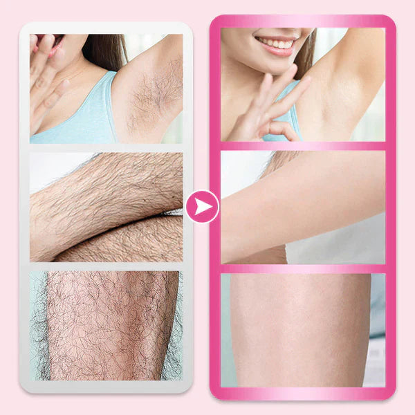 🎁LAST DAY-BUY 1 GET 1 FREE🎁Flawless & Gentle Hair Removal Cream
