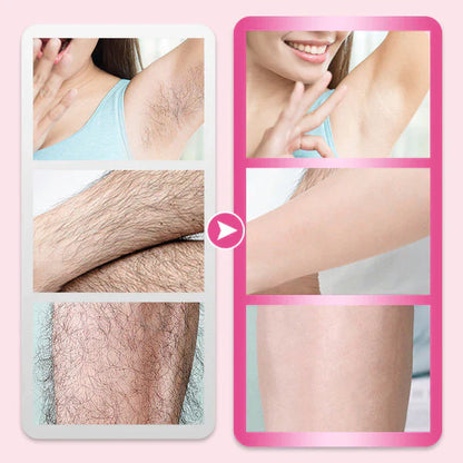🎁LAST DAY-BUY 1 GET 1 FREE🎁Flawless & Gentle Hair Removal Cream
